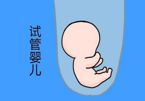 怎樣去美國(guó)做試管嬰兒